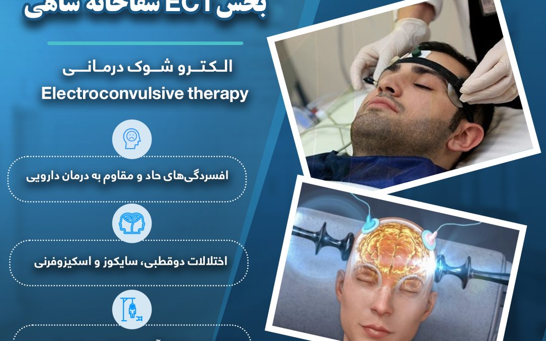 پیشرفته‌ترین بخش درمان‌های نوین (ECT)